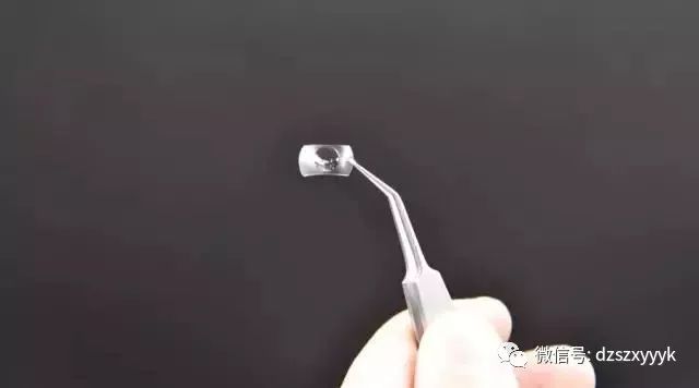 达州市中心医院眼科成功开展四川省公立医院首